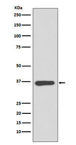 Annexin A10 Recombinant Rabbit Monoclonal Antibody (K01_3S49)