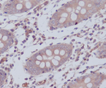 WAVE2 Recombinant Rabbit Monoclonal Antibody (K01_3S50)