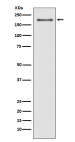 NSD3 Recombinant Rabbit Monoclonal Antibody (K01_3S51)