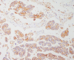 HLA-DRA Antibody in Immunohistochemistry (Paraffin) (IHC (P))