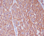 Cytokeratin 6A Antibody in Immunohistochemistry (Paraffin) (IHC (P))
