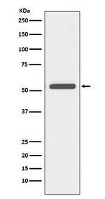 Cytokeratin 6A Antibody in Western Blot (WB)