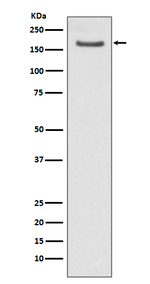 FANCD2 Antibody in Western Blot (WB)