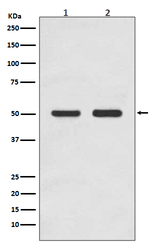 AP2M1 Recombinant Rabbit Monoclonal Antibody (K01_3S69)