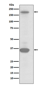 RON Recombinant Rabbit Monoclonal Antibody (K01_3S77)