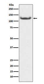 HDAC7 Recombinant Rabbit Monoclonal Antibody (K01_3S93)