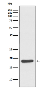 HSP20 Recombinant Rabbit Monoclonal Antibody (K01_3T09)