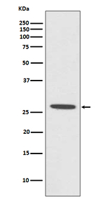 CDCA3 Recombinant Rabbit Monoclonal Antibody (K01_3T10)