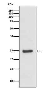 ZNRF2 Recombinant Rabbit Monoclonal Antibody (K01_3T18)