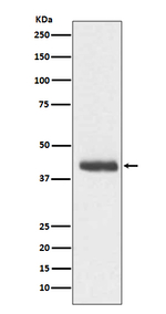 Doublecortin Recombinant Rabbit Monoclonal Antibody (K01_3T30)