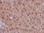 S100P Antibody in Immunohistochemistry (Paraffin) (IHC (P))