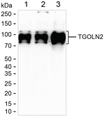 TGN46 Recombinant Rabbit Monoclonal Antibody (K01_3T46)
