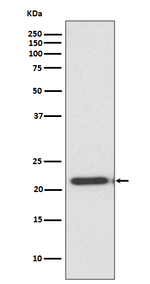 TIMP2 Recombinant Rabbit Monoclonal Antibody (K01_3T65)