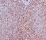 CD104 (Integrin beta 4) Recombinant Rabbit Monoclonal Antibody (K01_3T72)