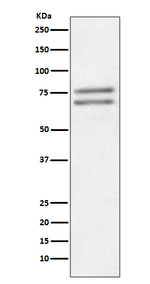 ADAM10 Recombinant Rabbit Monoclonal Antibody (K01_3T77)
