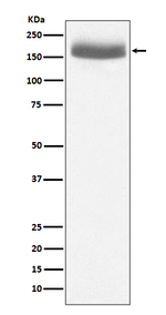 EGF Recombinant Rabbit Monoclonal Antibody (K01_3T82)