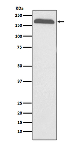 A2M Antibody in Western Blot (WB)