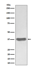 SFRP1 Recombinant Rabbit Monoclonal Antibody (K01_3T89)