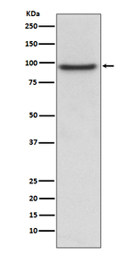 PROX1 Recombinant Rabbit Monoclonal Antibody (K01_3T91)