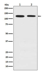 Drebrin Recombinant Rabbit Monoclonal Antibody (K01_3T93)