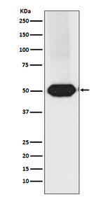 MEF2A/MEF2C Recombinant Rabbit Monoclonal Antibody (K01_3T99)