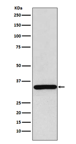 SGCG Recombinant Rabbit Monoclonal Antibody (K01_3U01)