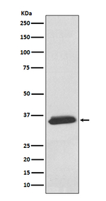 SGCD Recombinant Rabbit Monoclonal Antibody (K01_3U02)