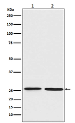 BNIP1 Recombinant Rabbit Monoclonal Antibody (K01_3U05)