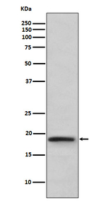 TNF beta Recombinant Rabbit Monoclonal Antibody (K01_3U10)