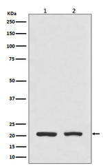 DHFR Recombinant Rabbit Monoclonal Antibody (K01_3U11)