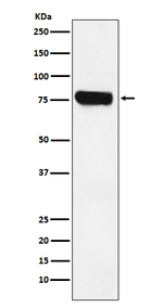 HEC1 Recombinant Rabbit Monoclonal Antibody (K01_3U13)