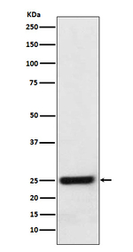 ERAB Recombinant Rabbit Monoclonal Antibody (K01_3U17)