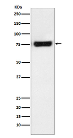 MTA2 Antibody in Western Blot (WB)