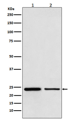 TBPL1 Recombinant Rabbit Monoclonal Antibody (K01_3U19)