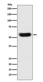 SERPINC1 Recombinant Rabbit Monoclonal Antibody (K01_3U29)