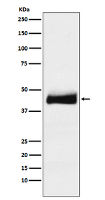 ORM1 Recombinant Rabbit Monoclonal Antibody (K01_3U31)