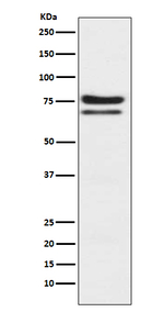 PKC epsilon Recombinant Rabbit Monoclonal Antibody (K01_3U38)