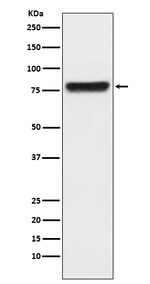Plasma Kallikrein Recombinant Rabbit Monoclonal Antibody (K01_3U39)