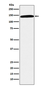 CD42b Recombinant Rabbit Monoclonal Antibody (K01_3U45)