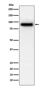 PDE4D Recombinant Rabbit Monoclonal Antibody (K01_3U55)