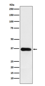 HSD11B1 Recombinant Rabbit Monoclonal Antibody (K01_3U57)