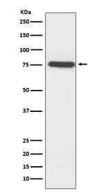 TAK1 Antibody in Western Blot (WB)
