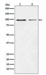 Dynamin 1 Recombinant Rabbit Monoclonal Antibody (K01_3U65)