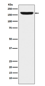 REST Recombinant Rabbit Monoclonal Antibody (K01_3U73)