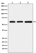 ELP3 Recombinant Rabbit Monoclonal Antibody (K01_3U76)