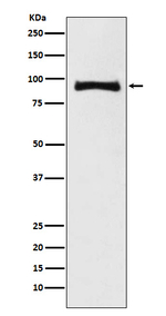 MALT1 Recombinant Rabbit Monoclonal Antibody (K01_3U86)