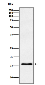 gamma Synuclein Recombinant Rabbit Monoclonal Antibody (K01_3U91)