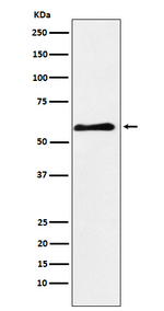 PAK3 Recombinant Rabbit Monoclonal Antibody (K01_3U94)