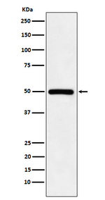 SETD8 Recombinant Rabbit Monoclonal Antibody (K01_3U98)
