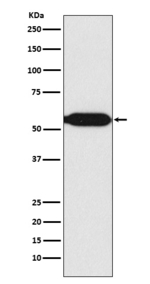 MEF2C Recombinant Rabbit Monoclonal Antibody (K01_3W20)